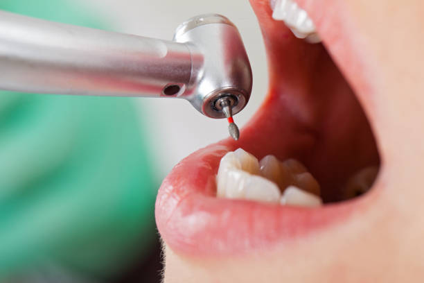 Best Weekend Emergency Dentist in Capitan, NM